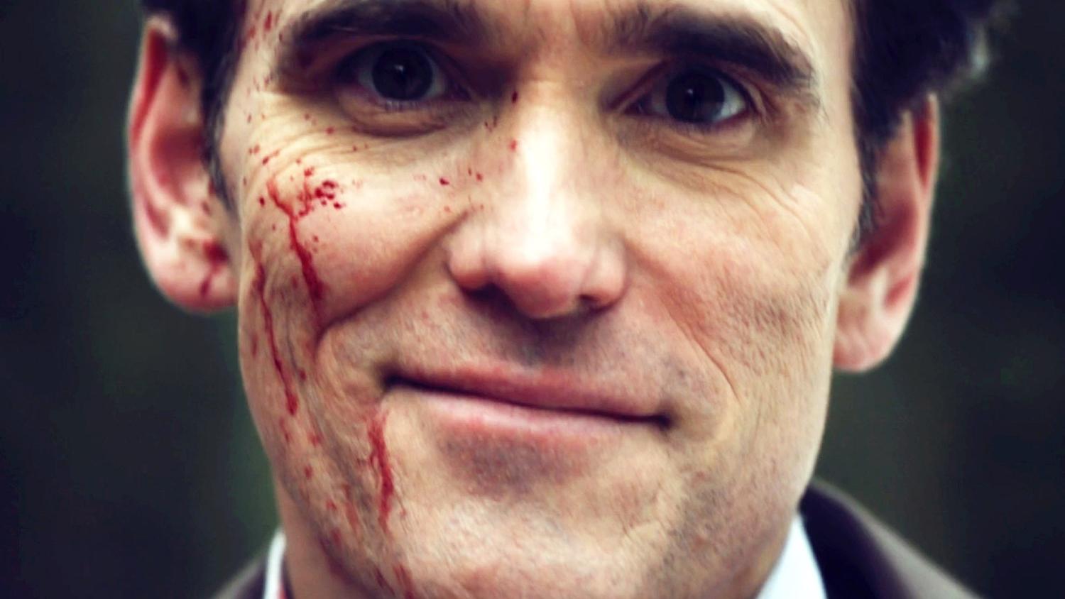 Matt Dillon